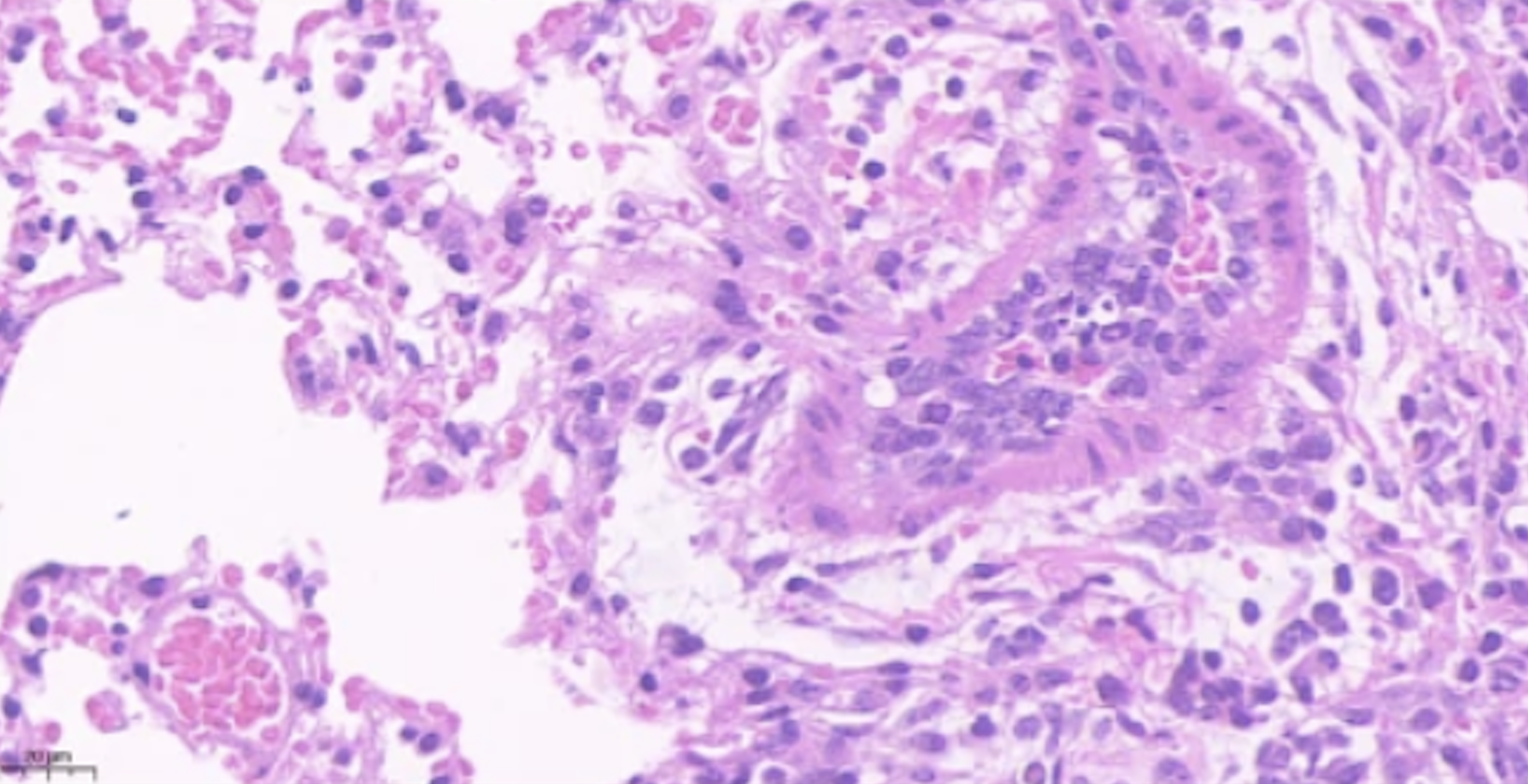 Angeletti Lab research photo 5